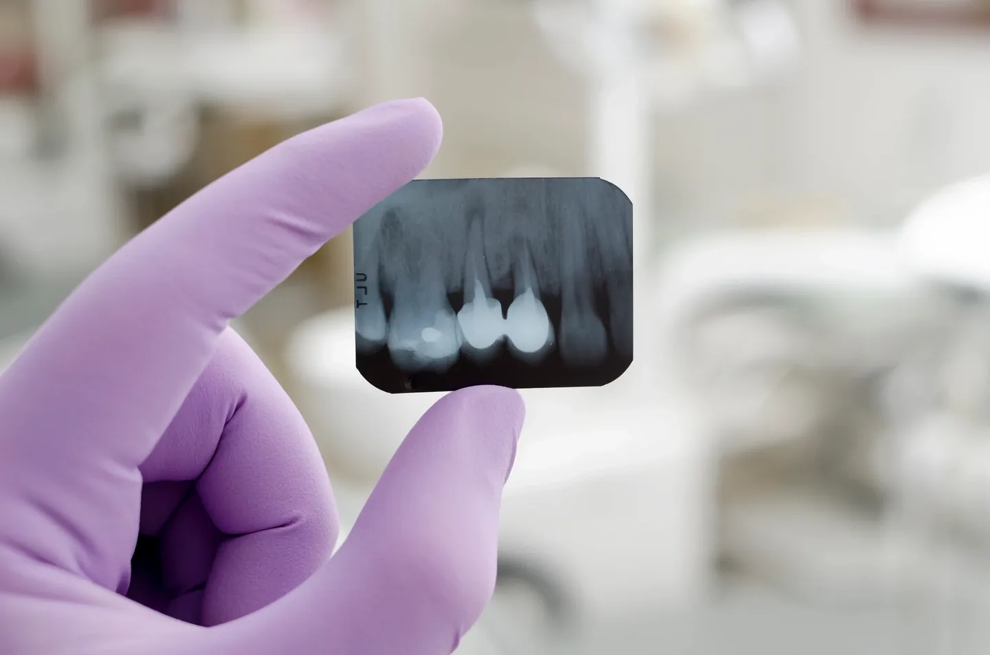 Diabetic Dental Care